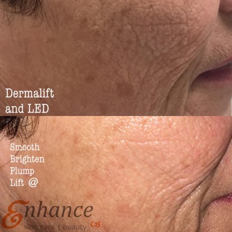 lift firm and energise your skin